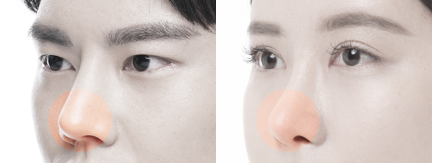 plastic surgery in korea for men