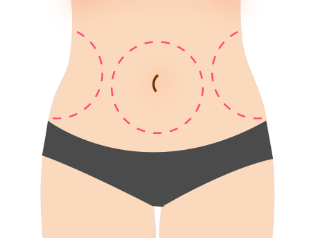 south korea liposuction cost