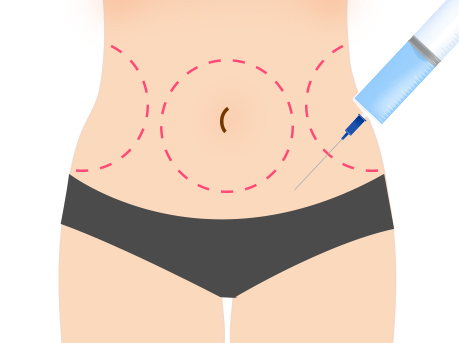 seoul liposuction