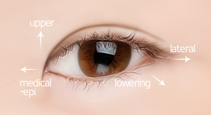 south korea canthoplasty